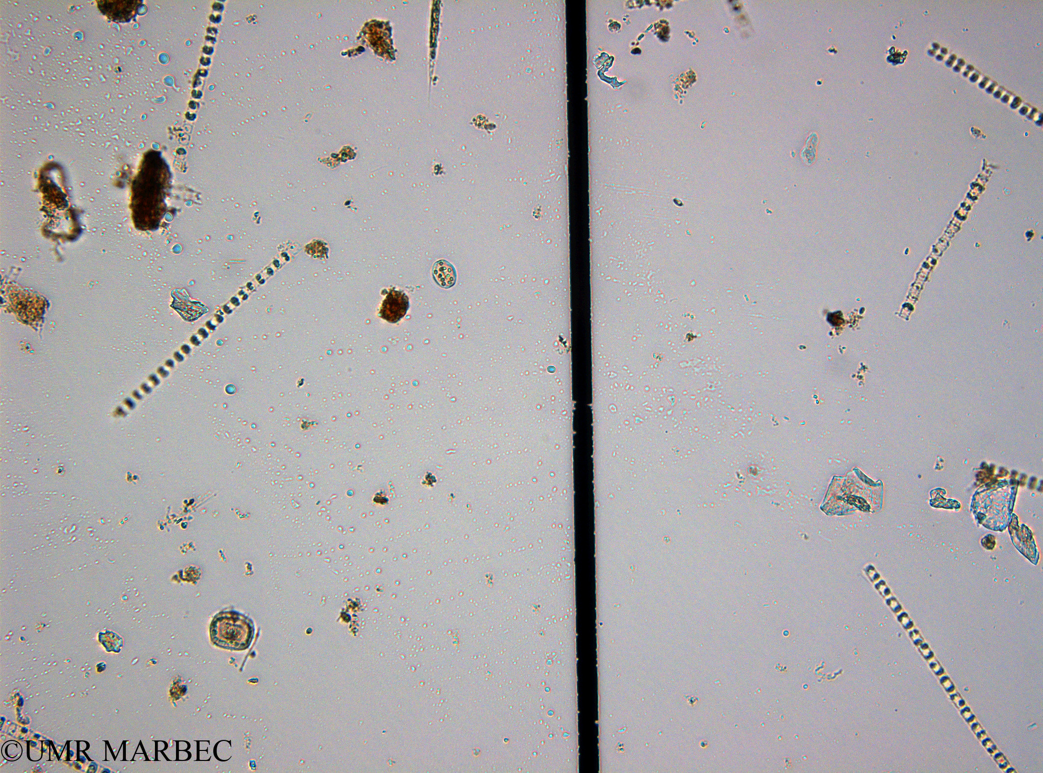 phyto/Guinea golf/Wouri_estuary_Chenal_2/YNkouefuthNfongmo_these 2022-2023/Centrique spp 5-10µm (old Centrique 9 small (Chenal2_SURF_2023_iden6230626_001).TIF(copy).jpg